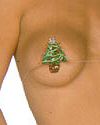 Christmas Tree Top